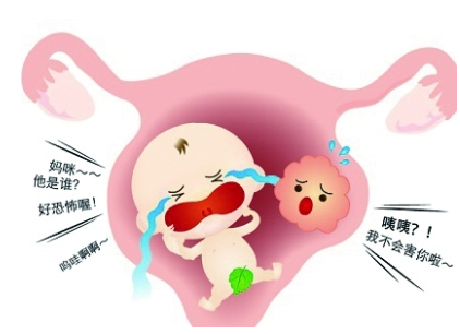 比如备孕女性发现子宫肌瘤的存在,如果肌瘤直径小于3公分且属于往外
